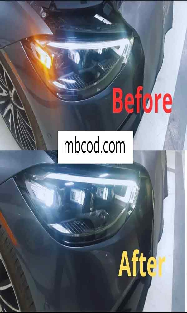 facelift